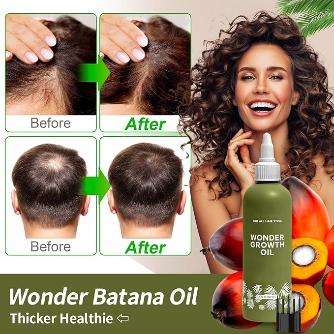 Glowic Wonder Growth Oil | Natural Hair Growth Treatment